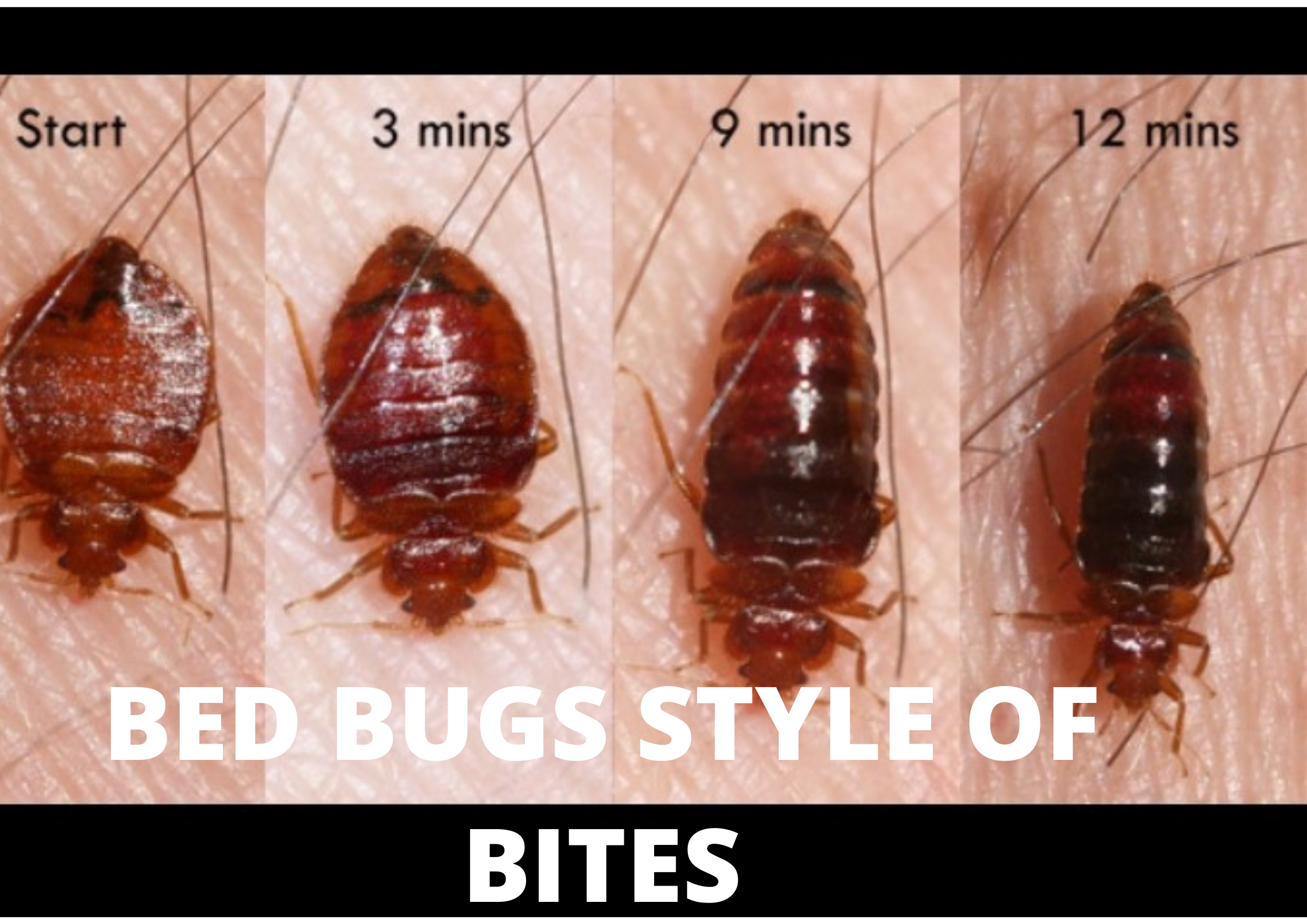 Side effect of Bed bugs Bites