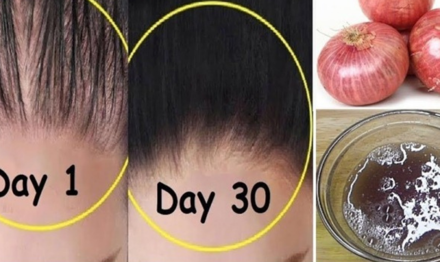 Best Home Remedy for hair loss treatment